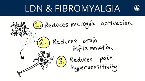 LDN in Fibromyalgia and Chronic Fatigue Syndrome