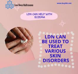 LDN can help with Eczema