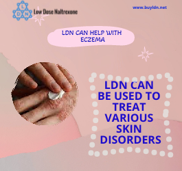 LDN can help with Eczema